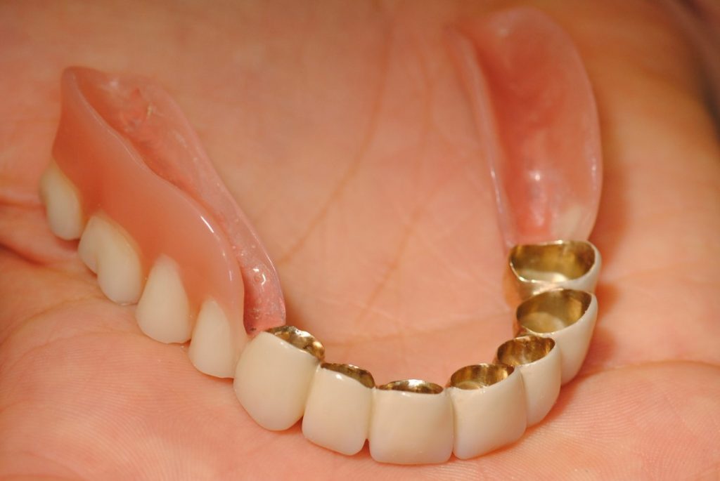 Die abnehmbare Brücke Zahnarztpraxis Dr. Wilharm